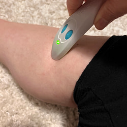 Mueckenstich_ole__12 von 12 im September 2022 von Sonja Fuchs alias Fuchsmunter Mueckenstich_ole__12 von 12 im September 2022 von Sonja Fuchs alias Fuchsmunter